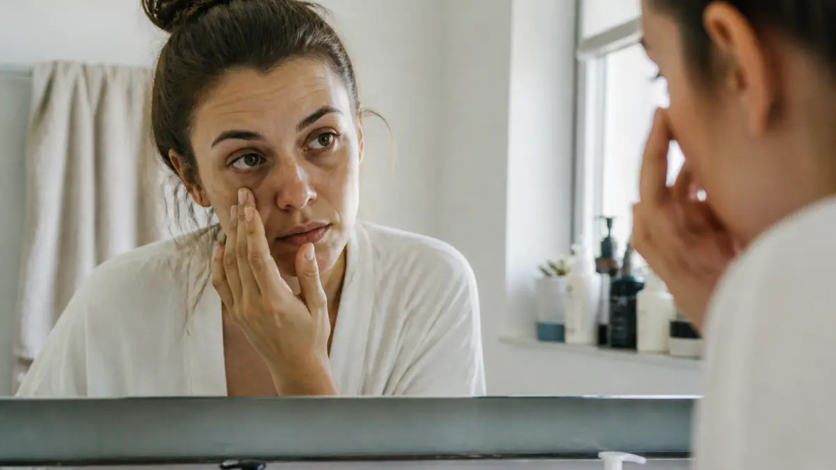 Cernes et poches sous les yeux : soins, hygiène de vie et options esthétiques